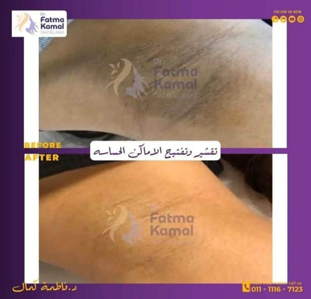 photo_10_2025-05-03_02-46-04